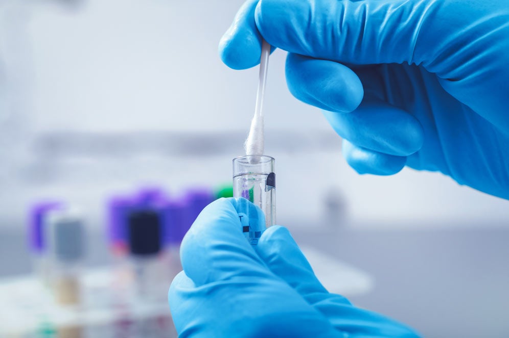 Lab sample and swab - Digestive Diagnostic Procedures article